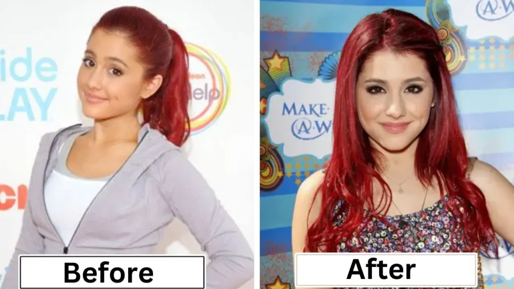 Comparison and the Unhealthie Ariana Grande Drastic Weight Loss