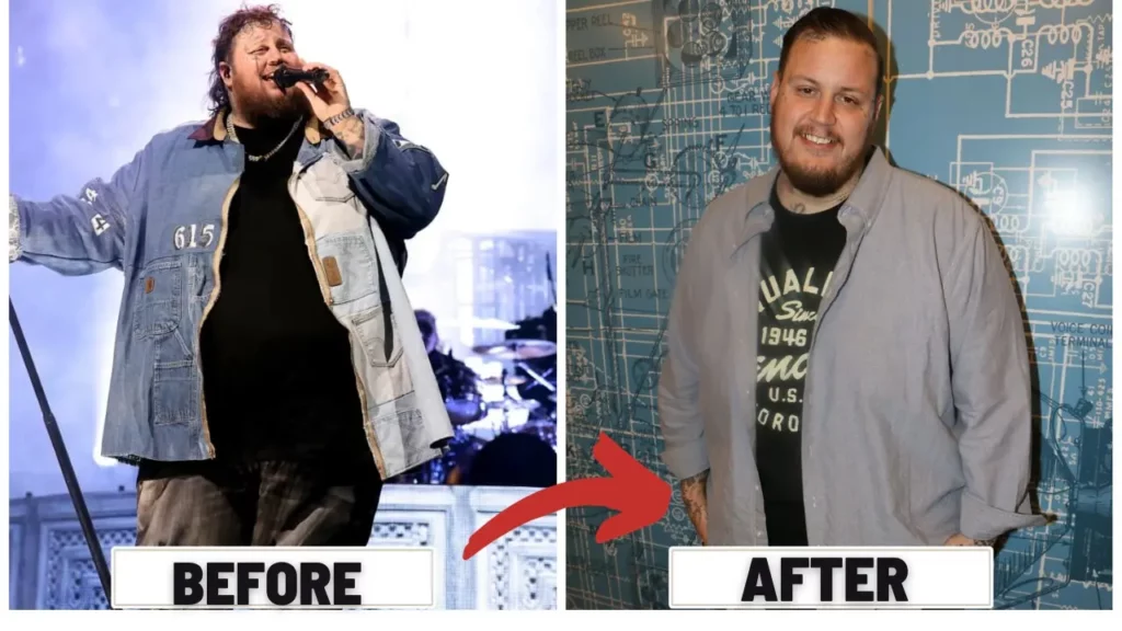 elly Roll Weight Loss Transformation in 2023